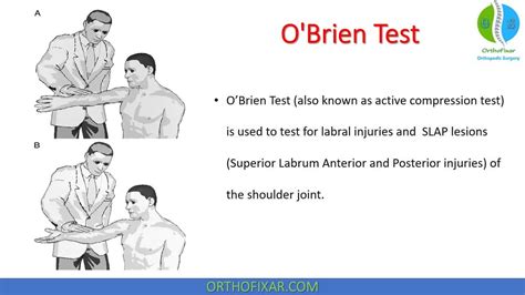It has been suggested that the positive position of the O'Brien test (shoulder flexion, horizontal adduction, and internal rotation) tensions the bicipital labral complex relative to the negative position (shoulder flexion, horizontal adduction, and external rotation). This study measured active and passive tension in the long head of biceps in ...